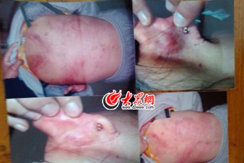 　山東藝術(shù)設(shè)計(jì)學(xué)院16歲女生宿舍內(nèi)被女同學(xué)暴打4小時(shí)。