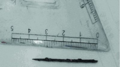 取出的繡花針已發(fā)黑生銹。