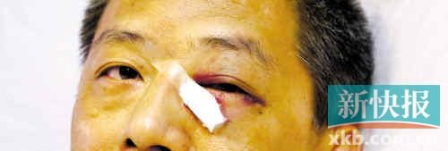 ■這起醫(yī)鬧事件，受傷的遠(yuǎn)遠(yuǎn)不只是熊旭明醫(yī)生的身體。