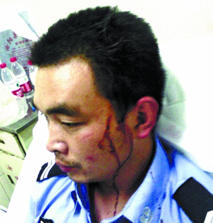 汝陽(yáng)協(xié)警遭賭徒暴力抗法并圍毆 公安局稱(chēng)這是內(nèi)部的事