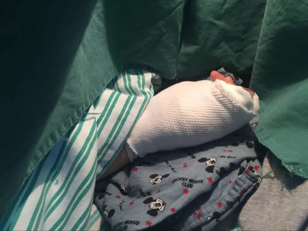 嚇哭！6歲男孩被夾斷手指 罪魁禍首竟是校服