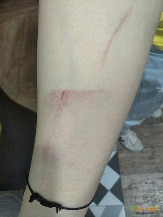 女網(wǎng)友舉報網(wǎng)帖中出示的被打后照片。