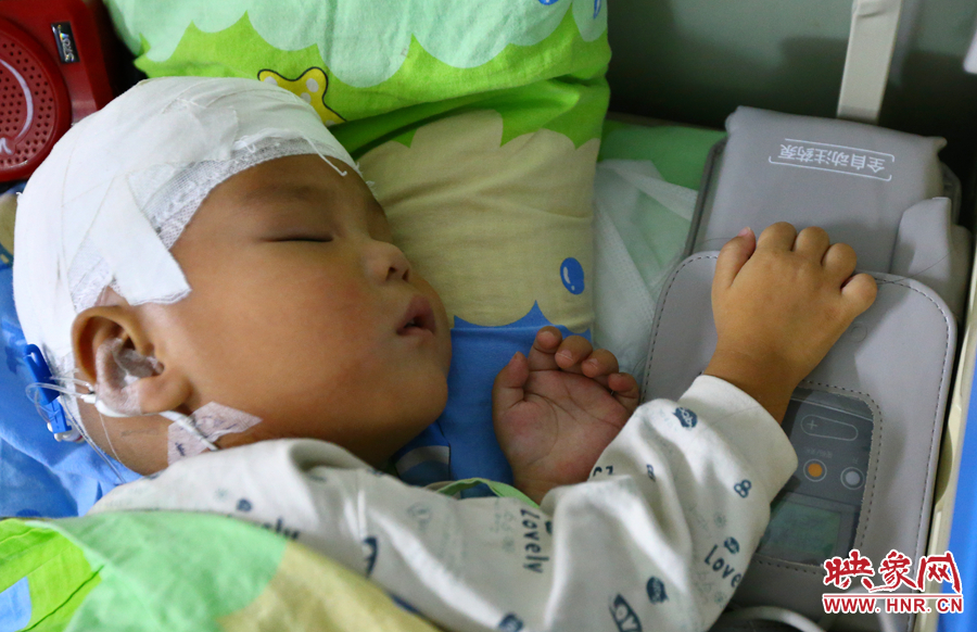 經(jīng)過手術(shù)，小龍病情已經(jīng)逐漸好轉(zhuǎn)，正在甜甜的熟睡