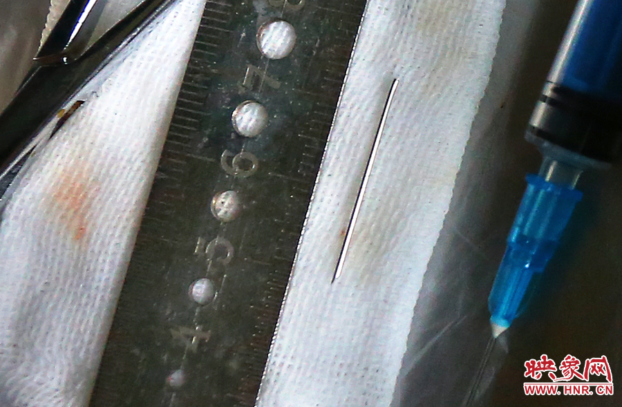 上午11點(diǎn)42分，大龍顱內(nèi)的鋼針被取出