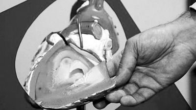 威廉斯領導的研究團隊已經(jīng)利用人體脂肪干細胞，成功3D打印出心臟血管和心臟瓣膜，待一顆心臟的所有部件打