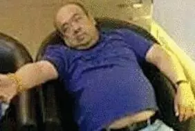 網(wǎng)傳金正男中毒后的照片。