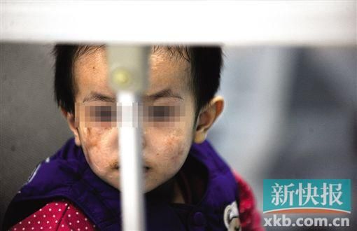 去年3月就能出院的小華(化名),目前還在廣州市婦兒醫(yī)療中心的PICU里住著。新快報記者 孫毅/攝