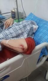 砸窗當(dāng)事人胡女士在醫(yī)院接受治療。