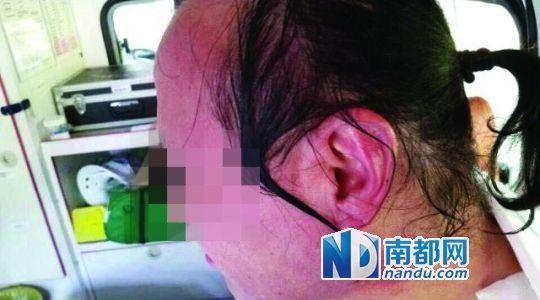 涉事教師遭熱水潑臉后的照片。