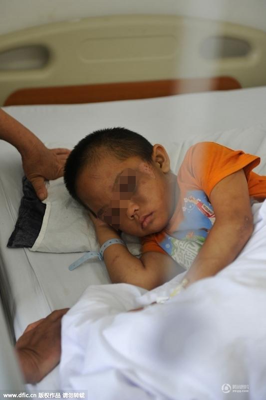 圖為全身傷痕累累的小進(jìn)。