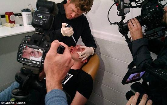 該實驗是由加州一支名為“生物駭客”的實驗團隊開展的。他們使用了一種名為二氫卟吩e6（Ce6）的物質(zhì)的溶液。Ce6常見于深海魚體內(nèi)，有光敏特性，通常用于癌癥治療研究中。研究團隊將Ce6與胰島素和鹽水混合起來，得到一種溶液，可以在低光照條件下提高人類的視力。